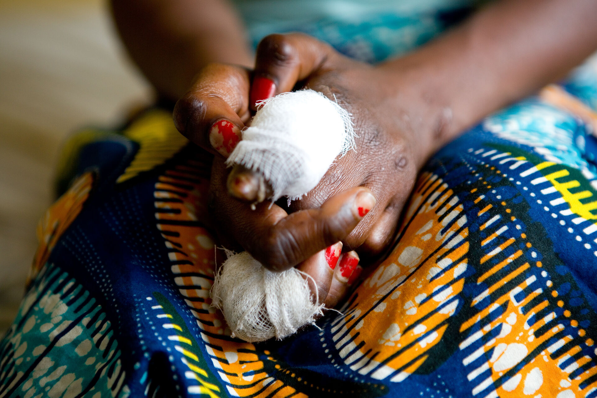 Close up shot of a womens hands which have bandages on them